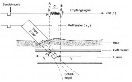 Prinzip der Duplexsonographie